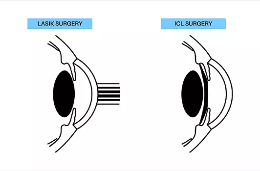 Retinitis Pigmentosa